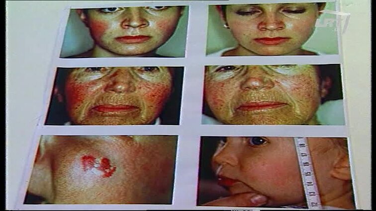 Panoramos archyvai. Lazeris