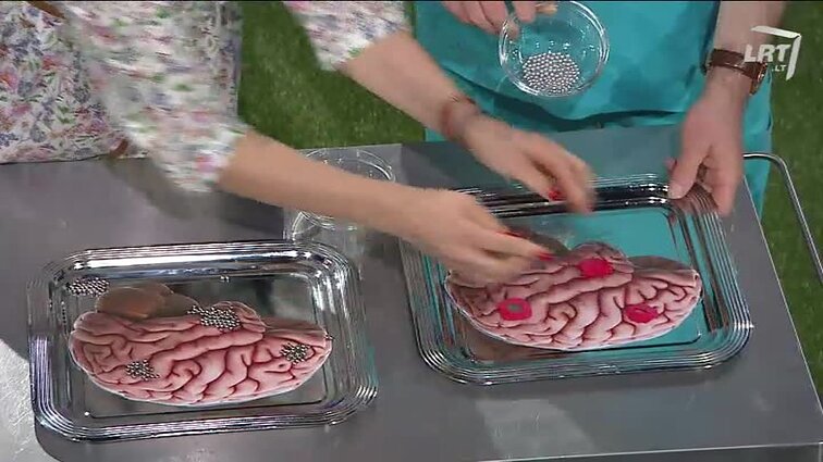 Eiga – ilga ir tyli, pasekmės – negrįžtamos: hepatitas C – be garso sliūkinantis smogikas