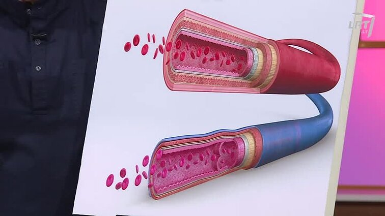 Klauskite daktaro 4 būdai kraujagyslių kalkėjimui mažinti. Pigmentinės dėmės ir apgamai: kaip mažinti?