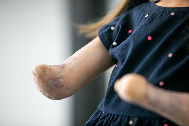 Diskusija „Meningokokas B: dabarties tendencijos ir apsauga“. Asociatyvi nuotr.