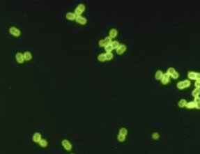Streptococcus pneumoniae bakterija