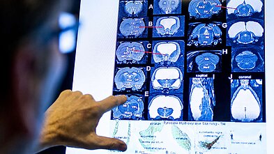 Žiurkės smegenų nuotrauka