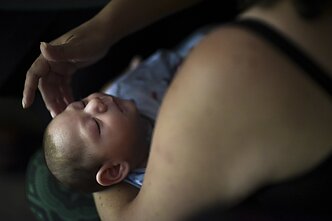 Zikos viruso sukelta infekcija taip pat laikoma reta liga