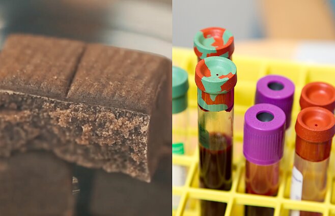 „Hematogenu“ geležies lygio pakelti nepavyks: kaip kovoti su mažakraujyste?