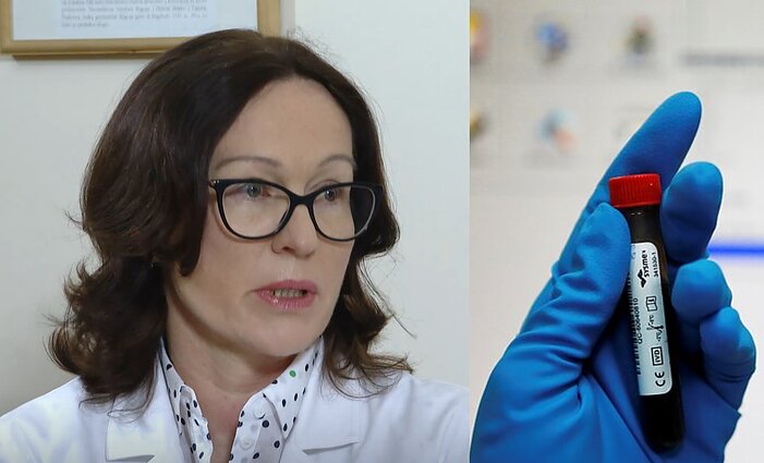 Infektologė apie koronaviruso pranašus: bendras kraujo tyrimas apie COVID-19 neišduos