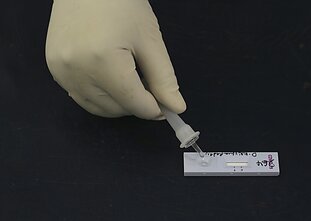 Greitieji koronaviruso testai