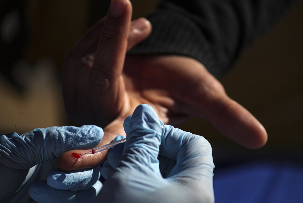 Rapid tests