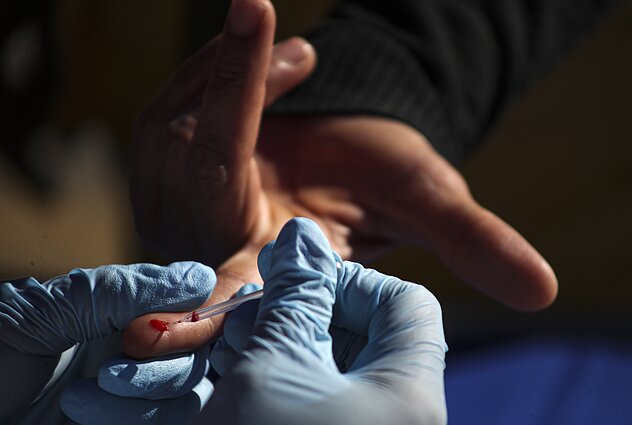Rapid tests