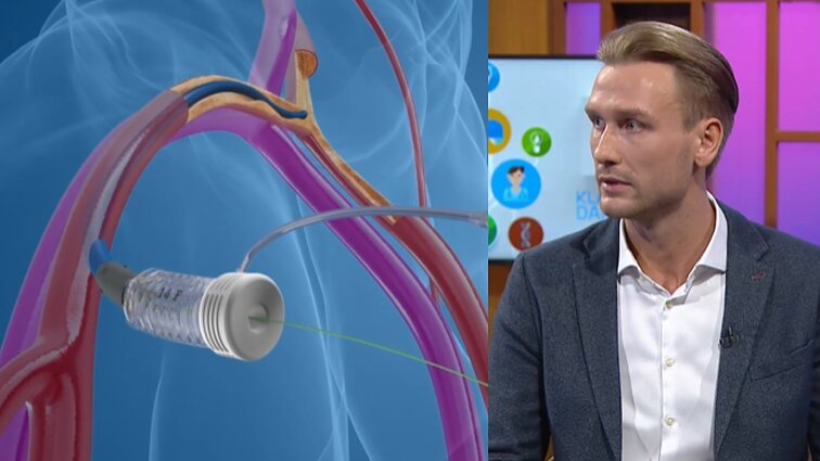 Medicinos stebuklas: širdies vožtuvo keitimas be pjuvio ir narkozės