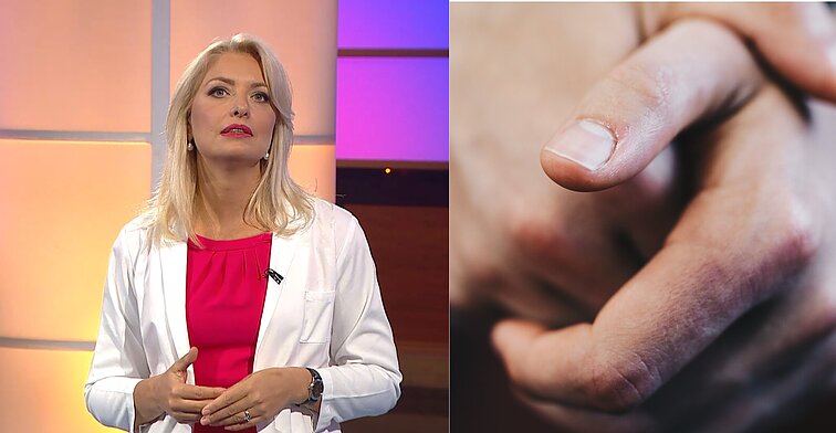 Nagų kramtymas – daugiau nei blogas įprotis: štai kokie pavojai už to slypi