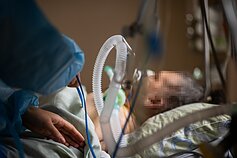 Dėl ūmiųjų kvėpavimo sutrikimų pacientai prijungiami prie plaučių ventiliavimo aparatų. Dėl ūmiųjų kvėpavimo sutrikimų pacientai prijungiami prie plaučių ventiliavimo aparatų.