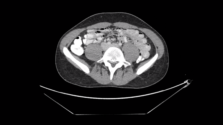 KLIPVID 2020. William Blake – „ensemble of terror“