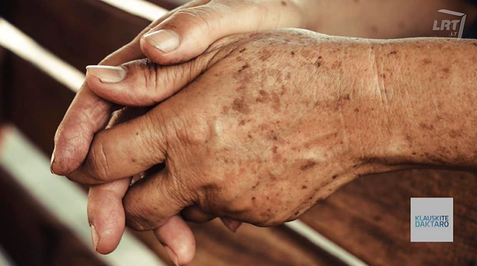 Unikauskas pataria, kaip su amžiumi išvengti pigmentinių dėmių atsiradimo: odą svarbu gydyti iš vidaus