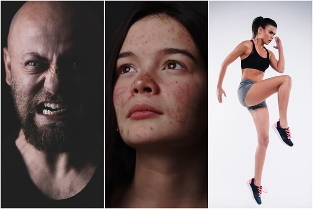 Klauskite daktaro. Pykčio tramdymas, patarimai, padėsiantys turėti lygią odą ir viso kūno stiprinimo treniruotė