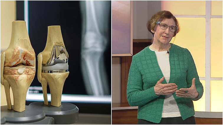 Su amžiumi išsivystanti osteoporozė: jos pasekmes patyrusi Irena sako – reikia išmokti su šia liga susigyventi