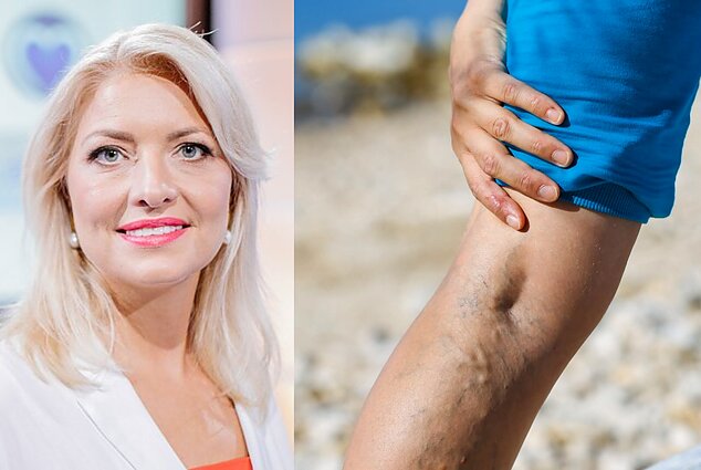 Kojų kraujagyslių užsikimšimas gali baigtis net kojų amputacija: kaip jį pastebėti?