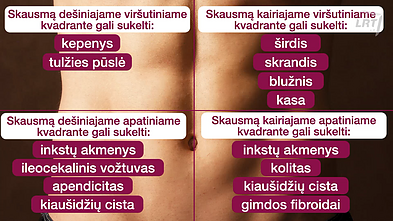 Pilvo srities skausmai
