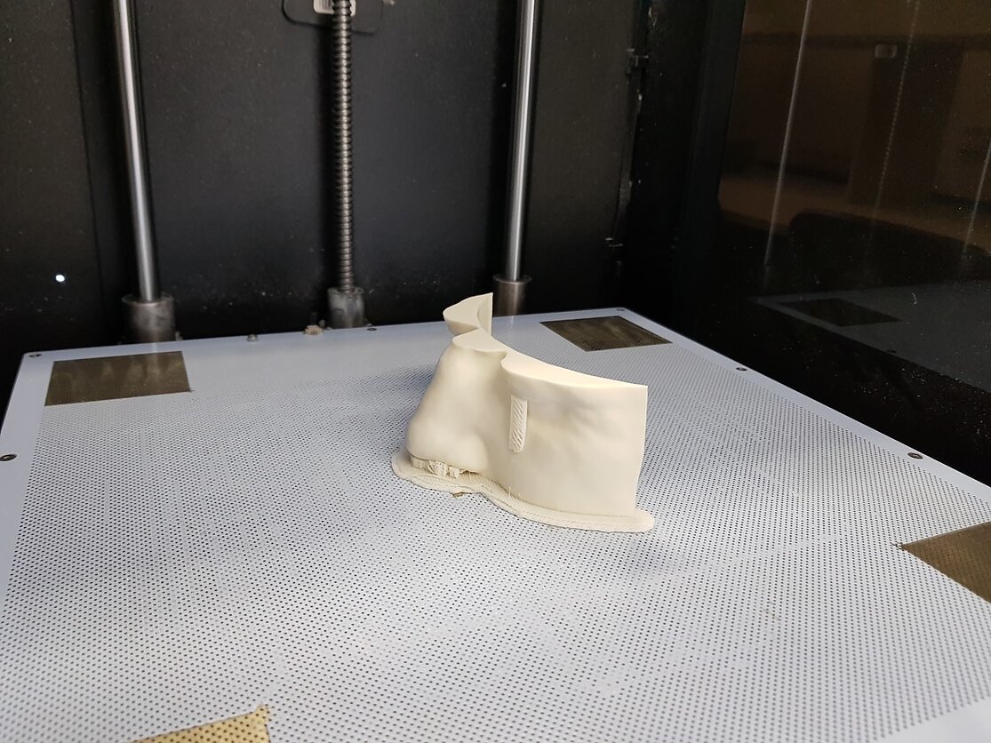 3D spausdinimas medicinoje 3D spausdinimas medicinoje