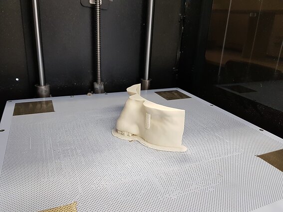 3D spausdinimas medicinoje 3D spausdinimas medicinoje