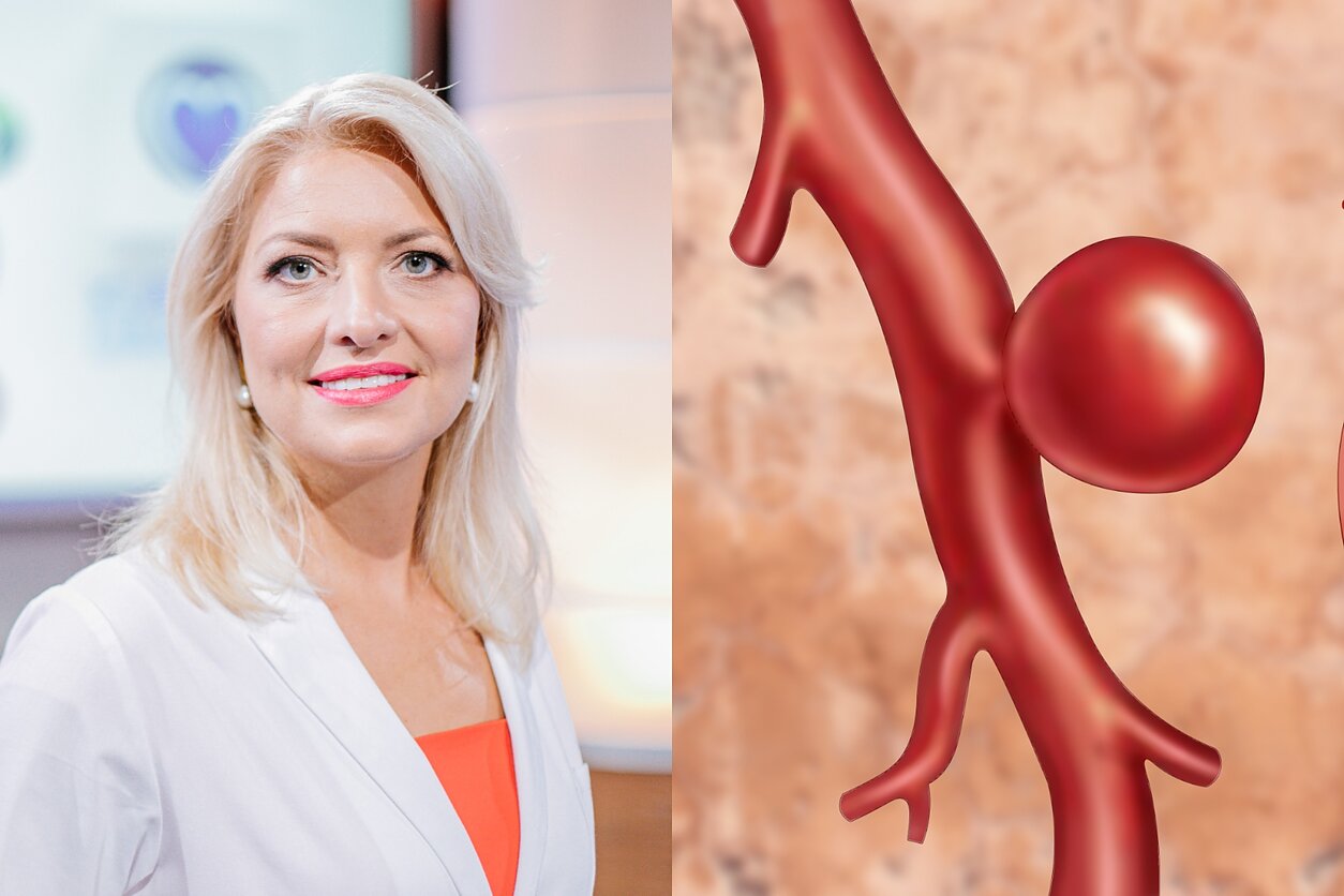 Jurgita Plisienė, aneurizma. Asociatyvus koliažas