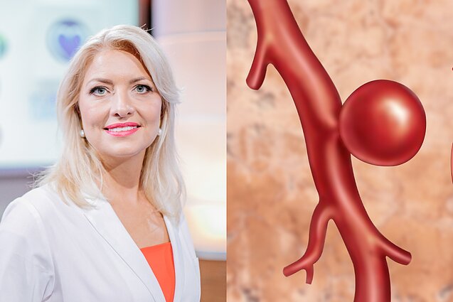 Jurgita Plisienė, aneurizma. Asociatyvus koliažas