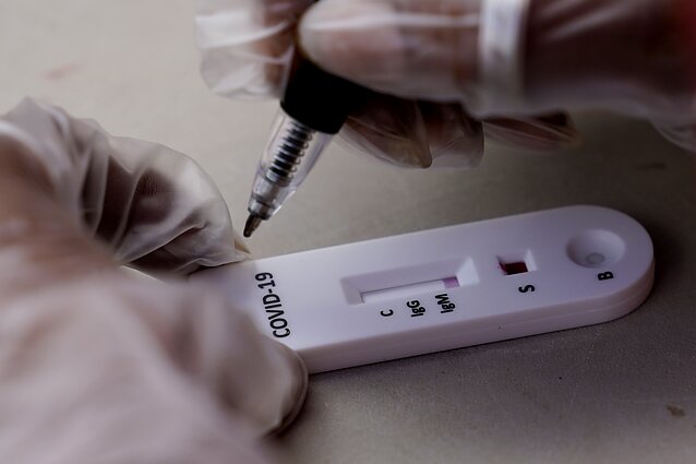 COVID-19 antikūnų testas