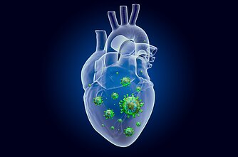 Miokarditas, širdis, virusai