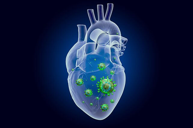 Miokarditas, širdis, virusai