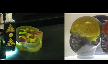 Atspausdintų 3D organų transplantacija gali padaryti perversmą