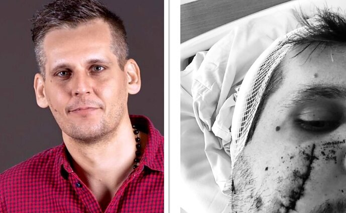 Mokytojas iš Klaipėdos Nerijus Dzingelevičius buvo sužalotas šių metų pavasarį