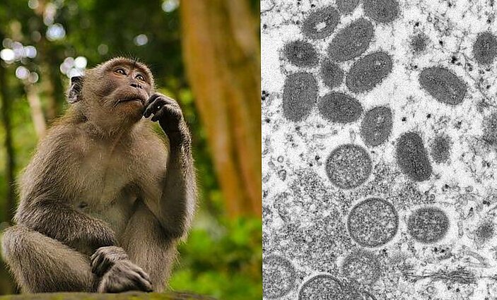 Laba diena, Lietuva. Beždžionių raupai pasiekė ir Europą: kokią grėsmę ši liga kelia žmonėms?