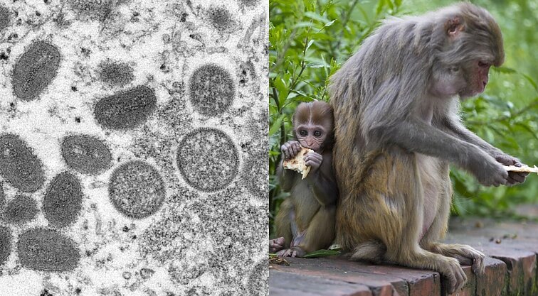 Žinios. Europoje vis sparčiau plinta beždžionių raupai: kasdien skaičiuojami nauji šios infekcijos atvejai