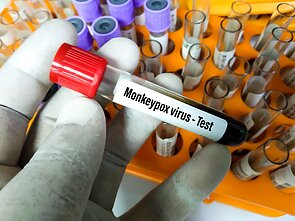 Beždžionių raupų viruso testavimas