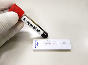 Beždžionių raupų viruso testas Beždžionių raupų viruso testas