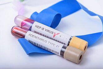 Adenovirusas ir hepatitas B Adenovirusas ir hepatitas B