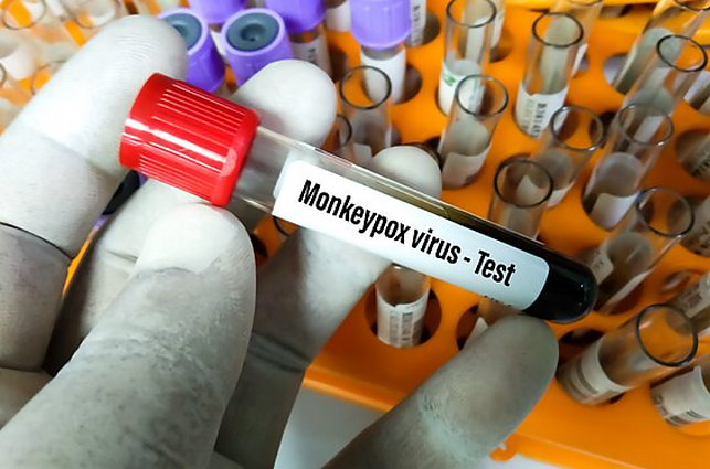 Žinios. PSO perspėja, kad raupai gali įsitvirtinti šalyse, kuriose anksčiau paplitę nebuvo