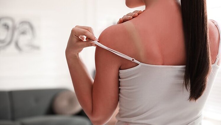 Labas rytas, Lietuva II d. Kaip vasarą tinkamai pasirūpinti savo oda?