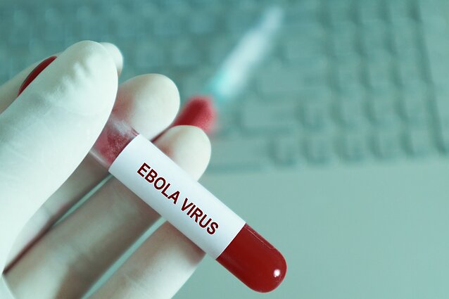 Ebolos virusas