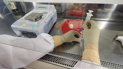 CAR-T terapija, asociatyvi nuotr.