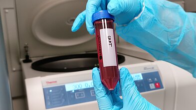 CAR-T terapija, asociatyvi nuotr.