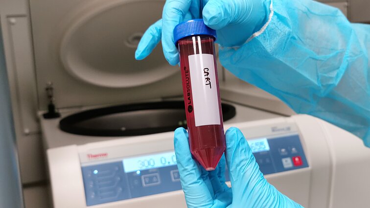 CAR-T terapija, asociatyvi nuotr.