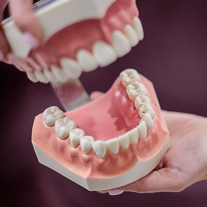 Sveikata. Odontologai: dantų ėduonis – ne normali būklė, o aplaidumo liga. Kaip jos išvengti?