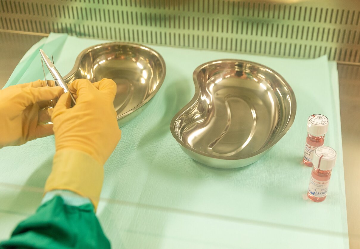 Kauno klinikų Audinių bankas, asociatyvi nuotr. Kauno klinikų Audinių bankas, asociatyvi nuotr.