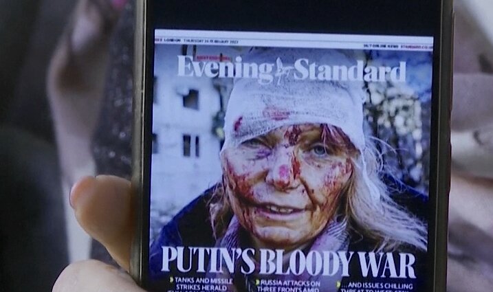 Pirmą karo dieną krentančių šukių sužalota Olena: sapnuose tik dabar neliko bombų, šūksnių, skausmo