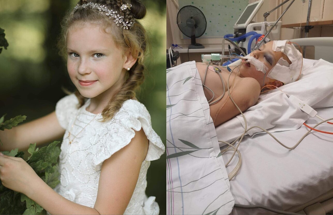 Alytaus Likiškėlių progimnazijos pradinukė Ugnė per avariją patyrė galvos traumą. 