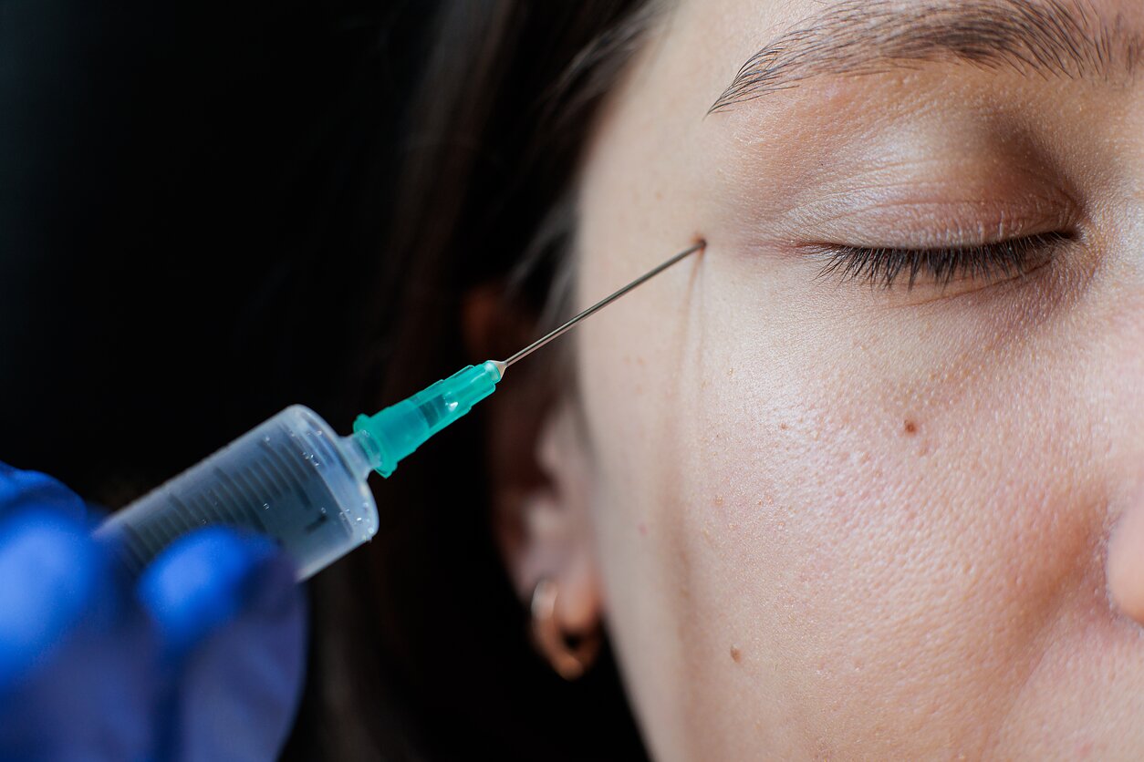Botulino injekcijos