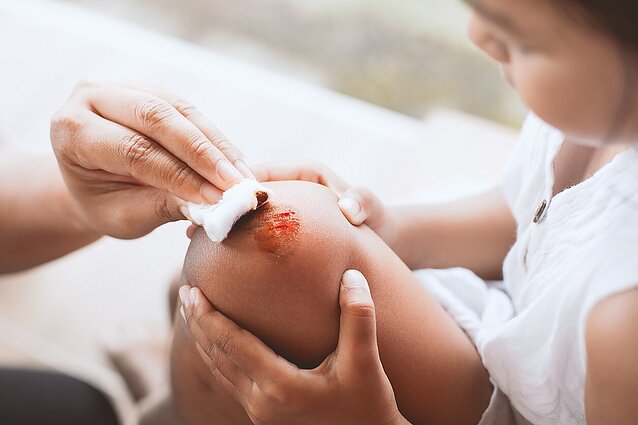 LSMU mokslininkai sukūrė odos plėveles žaizdoms gydyti: kuo jos pranašesnės už įprastus pleistrus?