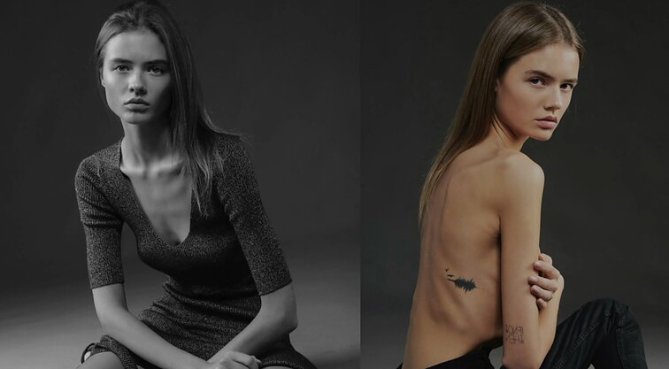 „Dar trys savaitės ir tavo kūnas būtų atsistatydinęs“: buvęs modelis Sima Jakulevičiūtė prisimena valgymo sutrikimų centre išgirstus žodžius