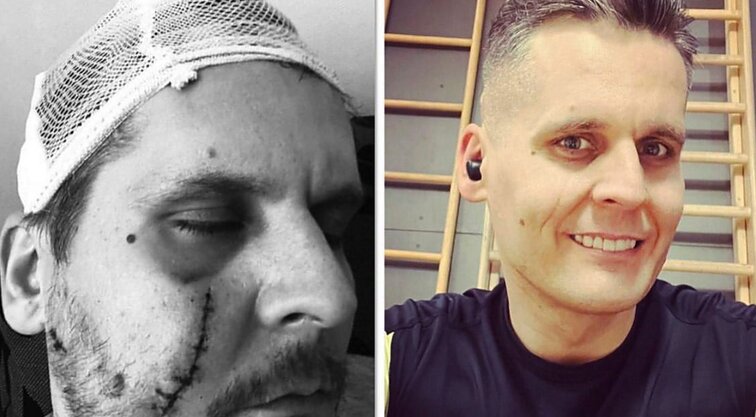 Išpuolį peiliu per stebuklą išgyvenęs mokytojas Nerijus apie sveikimo laikotarpį: buvo labai gėda, kai mane maudė žmona