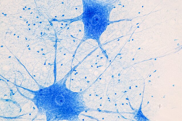 Neuronai, asociatyvi nuotr.